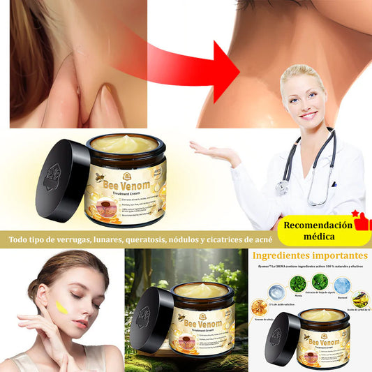 🌿🌿Turonu™ Crema de Tratamiento con Veneno de Abeja （Recomendado por dermatólogos🧑‍⚕️✅）