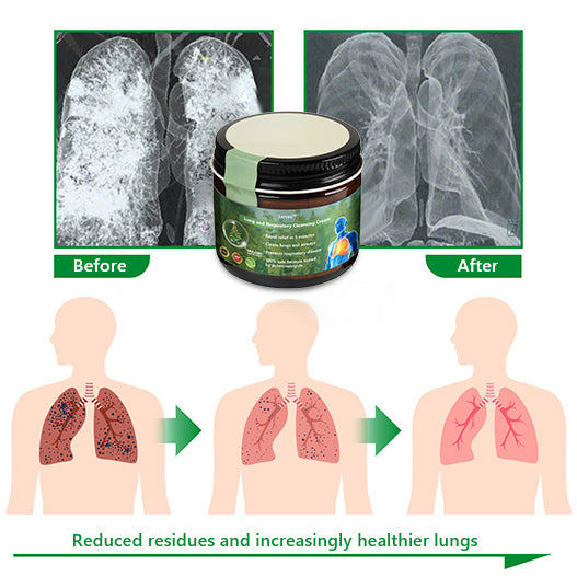 ✨Official Store:Lercea™ 👑Mullein Clear Lung Repair Cream - endorsed by the British Thoracic Society to support lung health🎉🎉