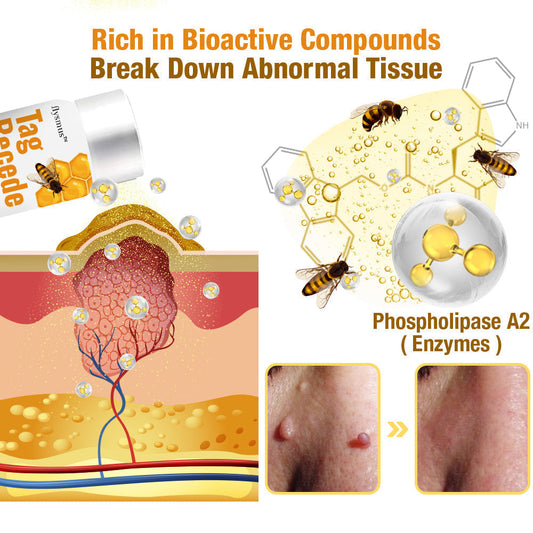 👨‍⚕️flysmus™ TagRecede Tratamiento contra el veneno de abeja