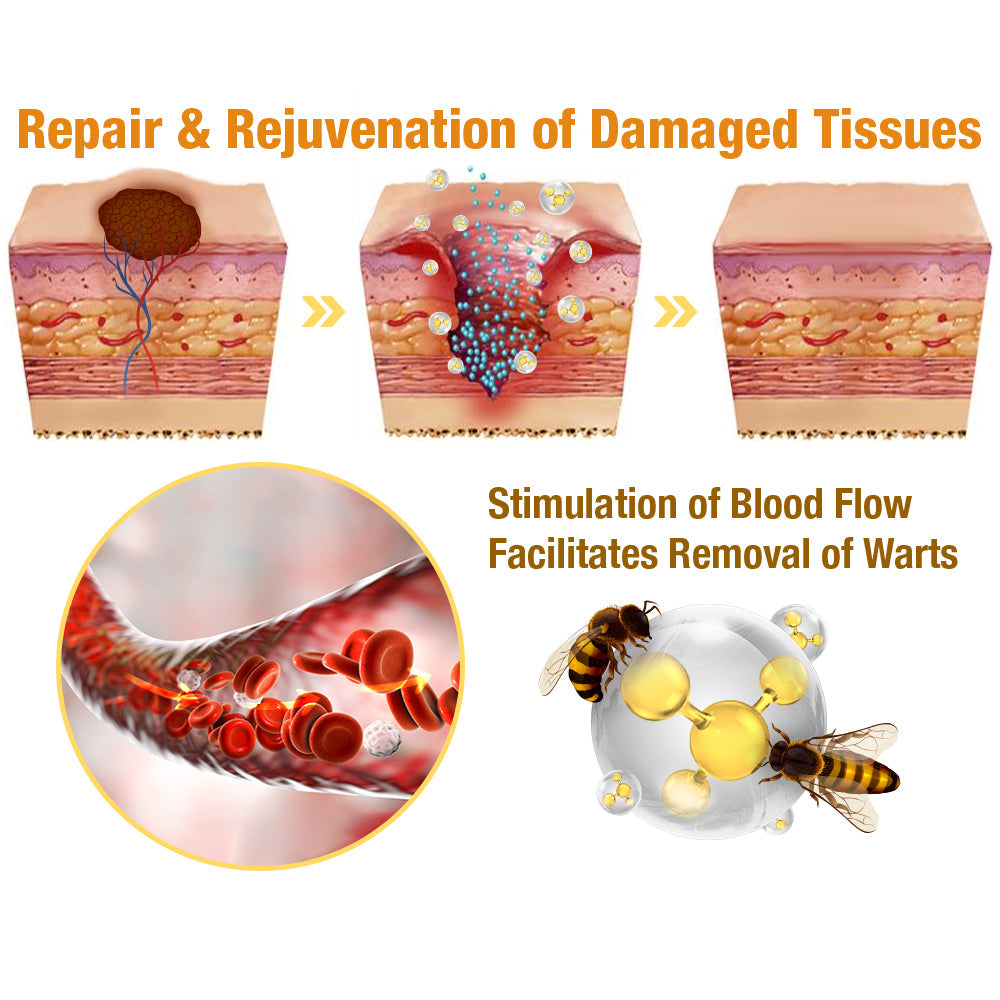 👨‍⚕️flysmus™ TagRecede Tratamiento contra el veneno de abeja